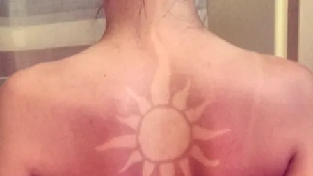 Nouă modă în materie de bronzat: „Tatuajele