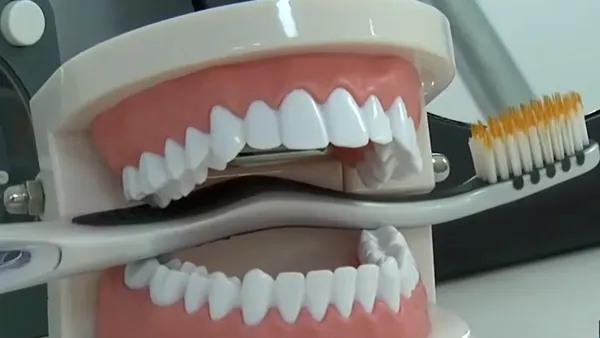Fabrica de dinți de la Miroslava, în rețeaua unui lider european din industria dentară. Tranzacție medicală importantă