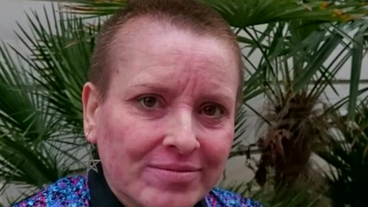 Berea care te „încinge