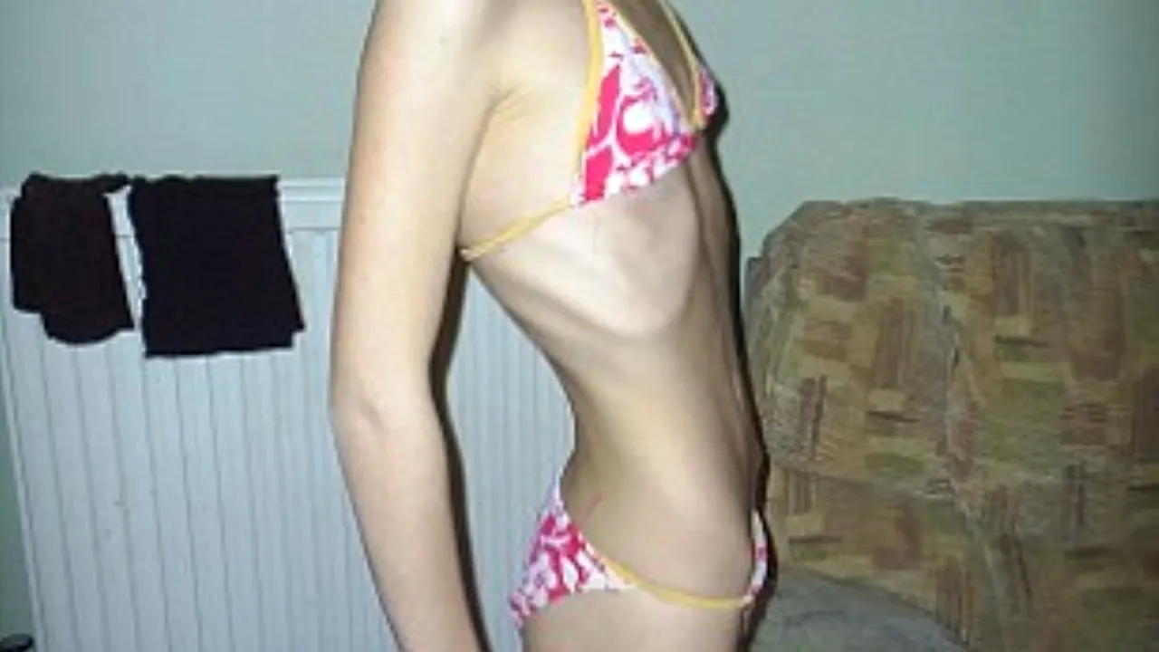 Cântărea doar 26 de kilograme. Cum arată această tânăra după ce s-a angajat la McDonald''s