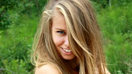 FOTO. Boala extrem de rară de care suferă această adolescentă. 