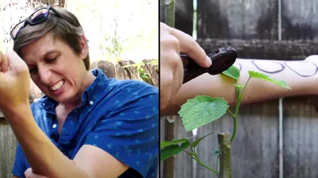 Cea mai PERICULOASĂ plantă din lume, care provoacă gânduri suicidale. Ce a pățit acest tânăr după ce a atins-o