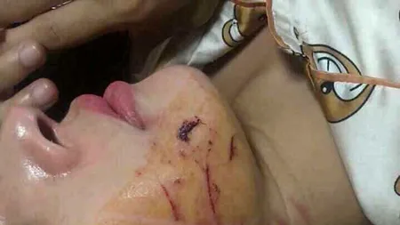 Amantă umilită în stradă de soția înșelată. A fost bătută, dezbrăcată și stropită cu un ulei urât mirositor FOTO