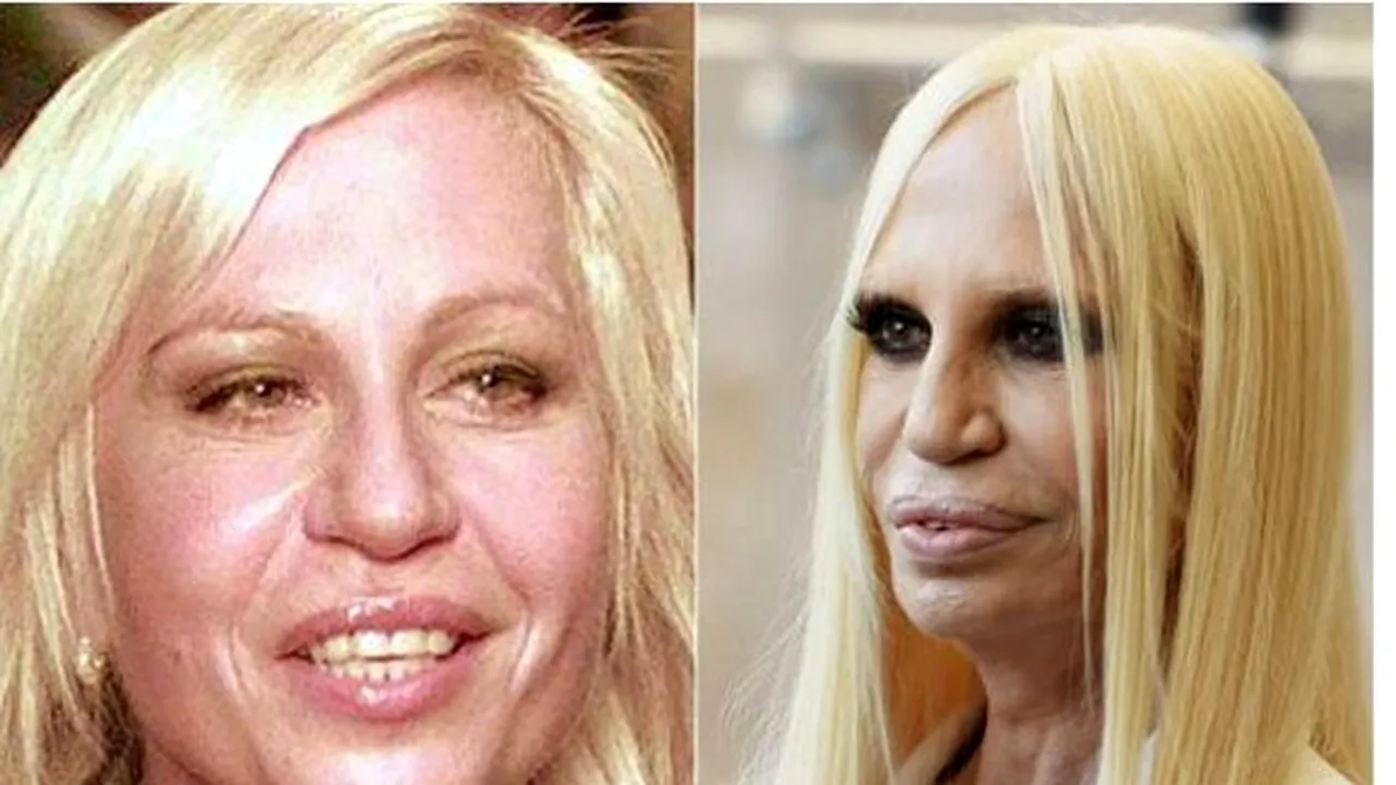 LOVITURĂ pentru divele care visau să întinerească peste noapte: Fără injecții cu BOTOX în perioada următoare, din cauza coronavirusului