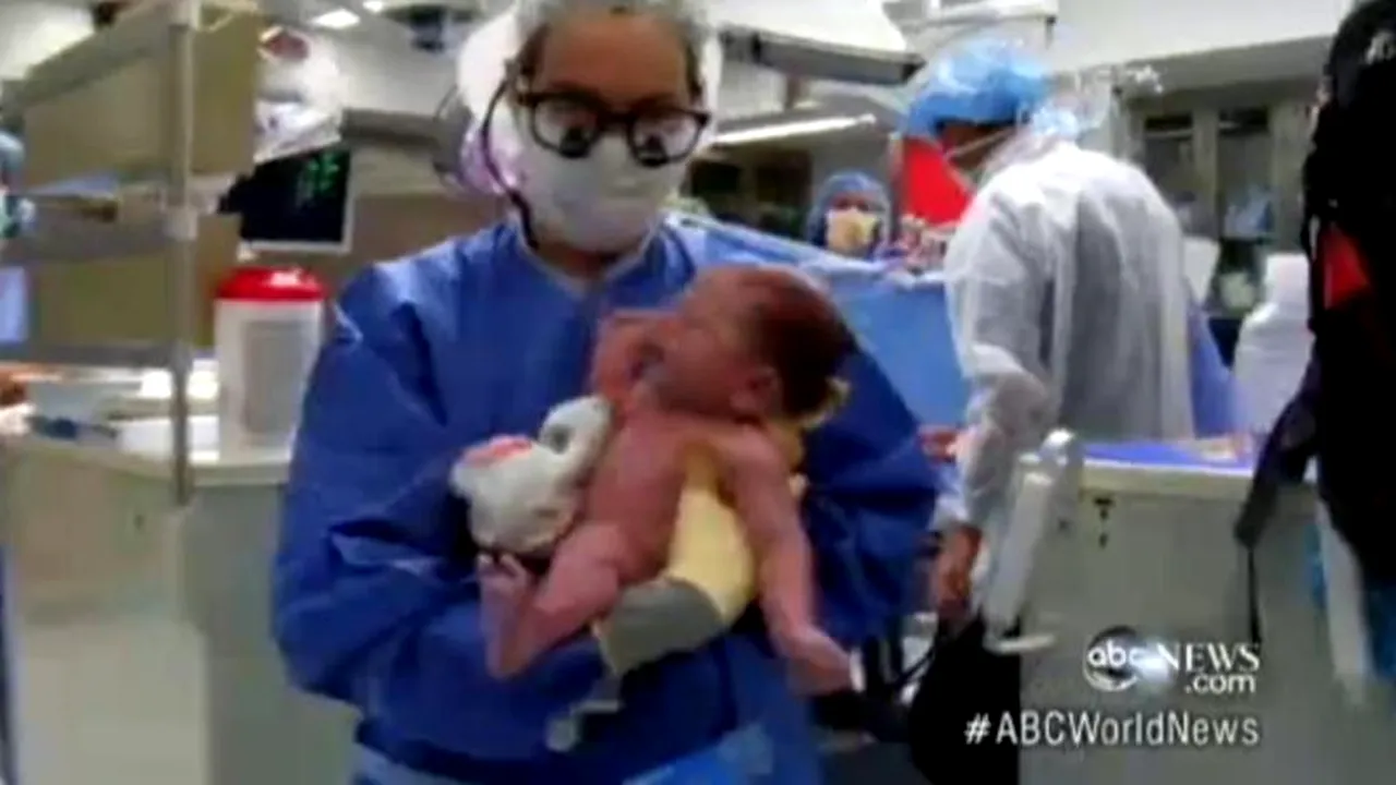 Intervenție chirurgicală miraculoasă în cazul unui bebeluș căruia nimeni nu îi dădea șanse
