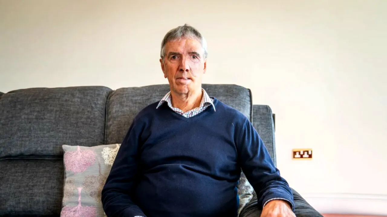 Bărbatul care și-a refăcut fața cu ajutorul tehnologiei 3D. ”Nu este cel mai plăcut proces”