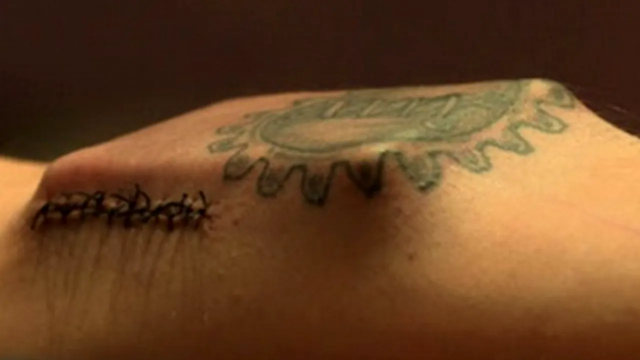 Un bărbat și-a instalat un cip imens sub piele, fără ajutorul medicilor. Cum funcționează acest dispozitiv