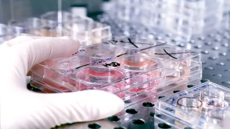 Cancerul intestinului gros, al treilea ca frecvență a bolilor oncologice, depistat cu un test simplu