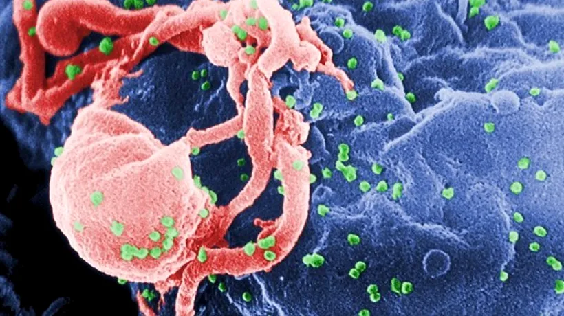 Savanții spanioli au descoperit molecula virusului HIV care este responsabilă de apariția SIDA în organism