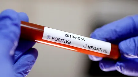 COVID-19. Ce se întâmplă cu asimptomaticii. Tătaru: Decizia va fi a medicului curant