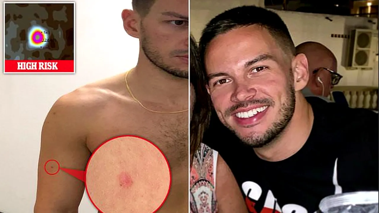 O aplicație l-a avertizat pe un tânăr că suferă de o formă mortală de cancer. Mi-a salvat viața