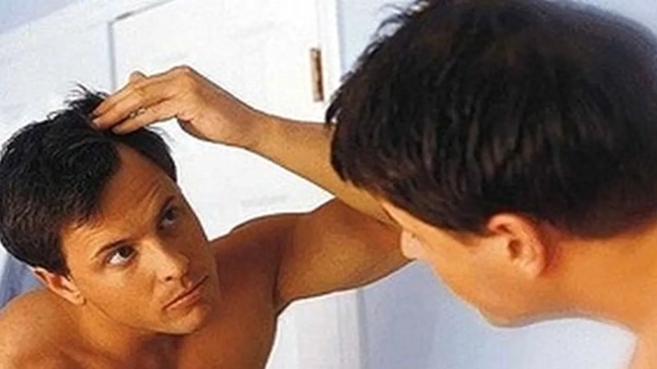 STUDIU. La ce riscuri se expun bărbații cu chelie