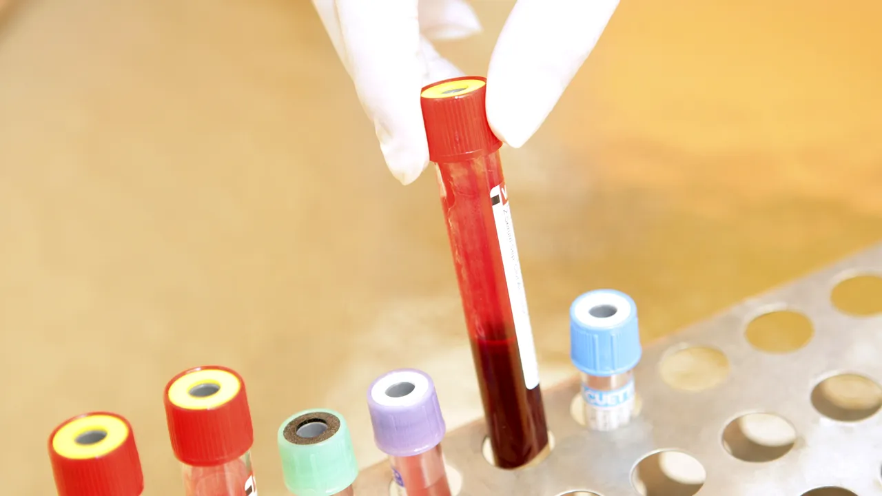 Lista completă de INVESTIGAȚII care trebuie făcute, în funcție de VÂRSTĂ. Ce ANALIZE sunt recomandate la început de an