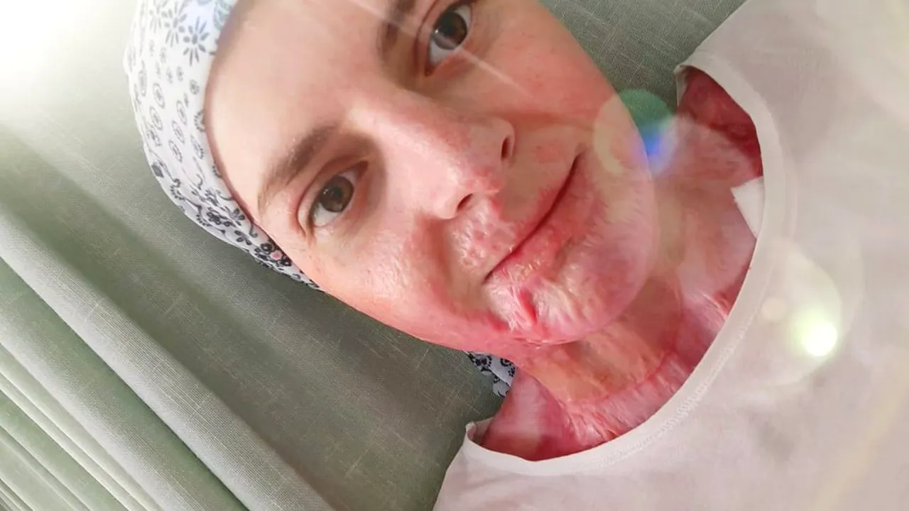 Fata din Mehedinți incendiată de Ion Turnagiu, criminalul eliberat condiționat, mesaj emoționant în Ajunul Crăciunului: “Datorită vouă, oameni minunați, sunt bine!”