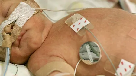 Copilul româncei din Italia violată de doi militari SUA s-a născut cu grave probleme de sănătate