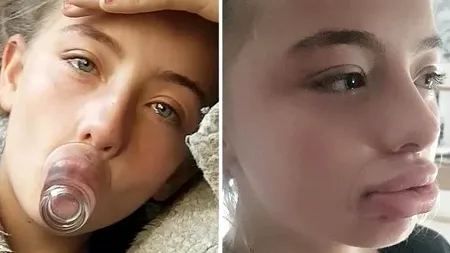 O fată de 12 ani și-a „distrus