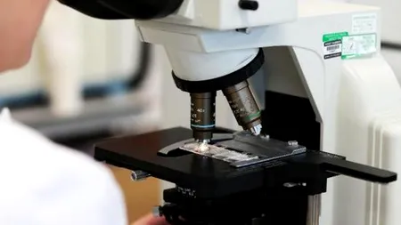 STUDIU. Cancerul nu apare din cauza viicilor sau a factorilor ereditari. E vorba doar de 