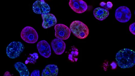 Primele celule artificiale care ar putea lupta împotriva cancerului. Sunt o alternativă promițătoare la tratamentele obișnuite