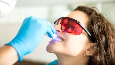 (P)Fațete dentare vs. albire: Care este soluția potrivită pentru tine?