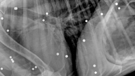 A fost împușcat de 100 de ori și a supraviețuit. Medicii au fost uluiți când au văzut radiografia