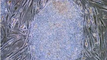 Descoperire de senzație a cercetătorilor japonezi. Este un pas uriaș în lupta cu cancerul