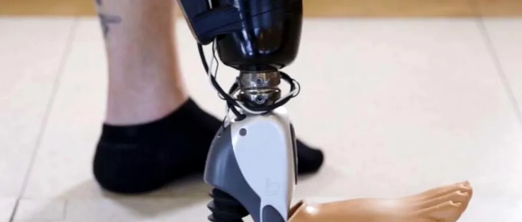 Noi senzori le permit persoanelor cu membre amputate să își miște picioarele bionice prin puterea gândului