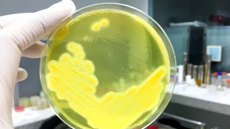 O BOALĂ contagioasă se răspândește în Japonia. Rata mortalității ajunge la 30%!