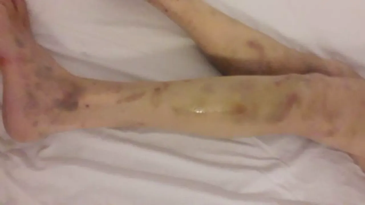 Acuzații de maltratare și neglijență la un azil din Câmpina, după ce un vârstnic a fost găsit de fiica sa plin de răni și înfometat: „Tata mi-a spus că acolo era pușcărie”