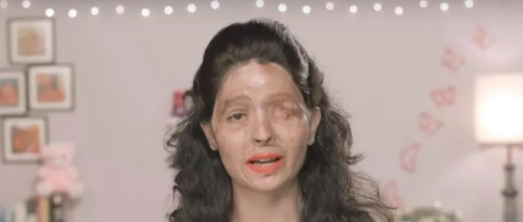 A fost arsă cu acid sulfuric la 17 ani. Acum a făcut un tutorial de make-up care transmite un mesaj cutremurător