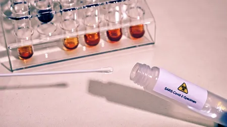 Bilanț Covid în România, 25 august 2021. Un nou record de cazuri noi de COVID-19, raportat în ultimele 24 de ore