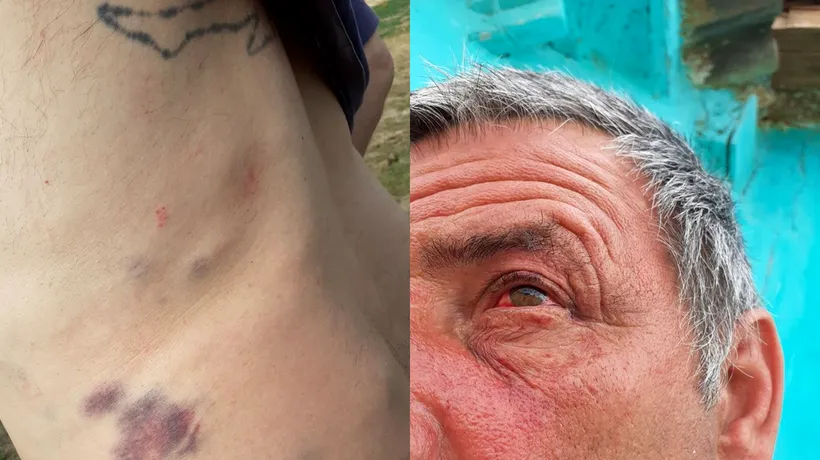 ACUZAȚII GRAVE. Un bărbat care conducea o căruță susține că a fost bătut „degeaba” cu brutalitate de către polițiști și jandarmi - FOTO/VIDEO