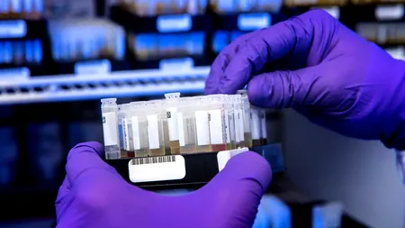 OMS Europa: Este necesar ca statele membre să sporească accesul la testarea gratuită pentru a combate tulpina Delta