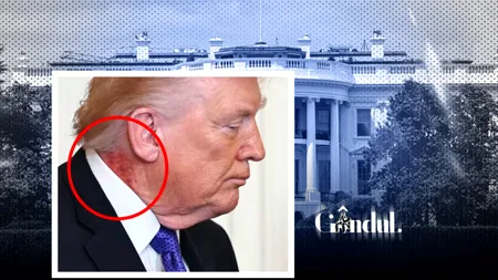 Ce se întâmplă cu pielea lui Donald Trump. Medicul său a venit cu explicații după ce imaginile au devenit virale