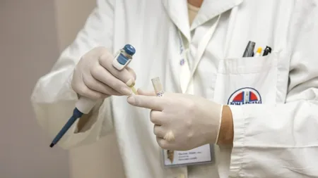 ALERTĂ. Rujeola ia amploare în România: încă 57 de cazuri noi, iar bilanţul a ajuns la aproape 20.000 de bolnavi