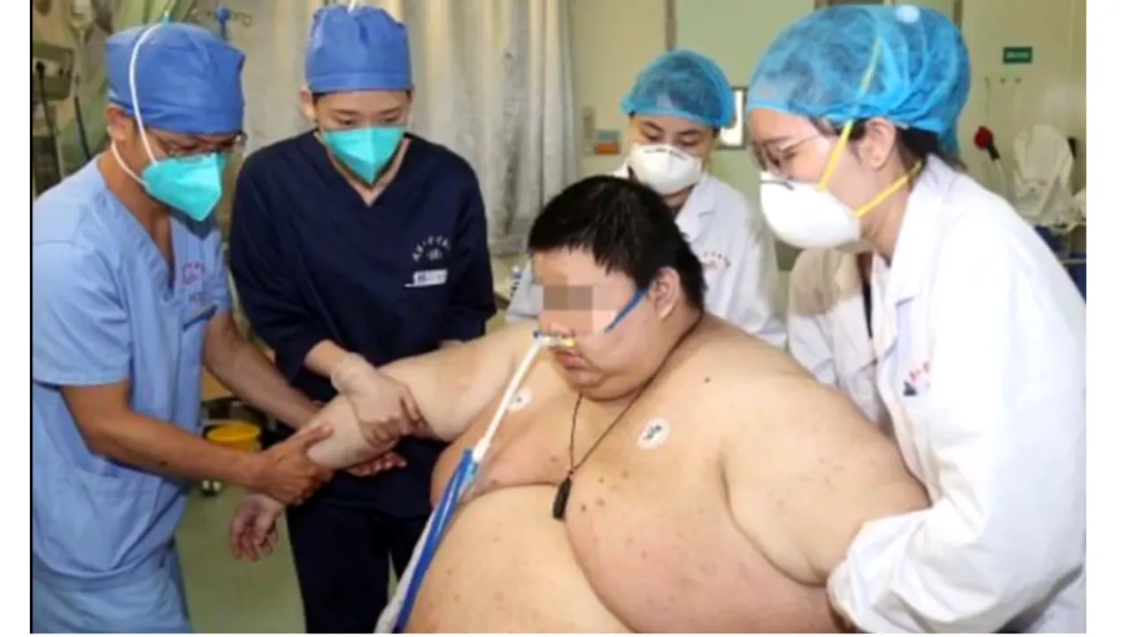 GALERIE FOTO. Un tânăr de 26 de ani s-a îngrășat 100 de kilograme în timpul în care a stat în carantină