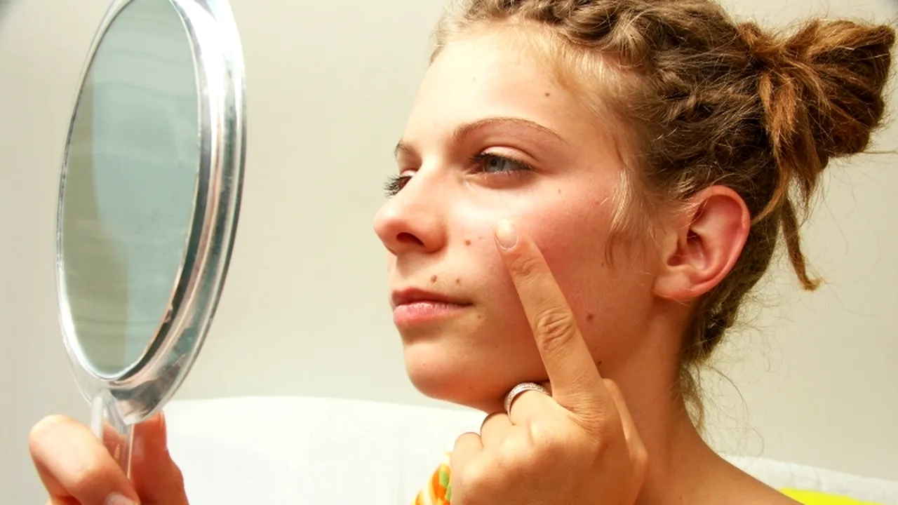 Aplicația care promite că te scapă de acnee