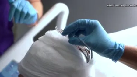 Inovație în lumea medicinei. Descoperirea care poate face ca amintirile unei persoane să poată fi „recuperate