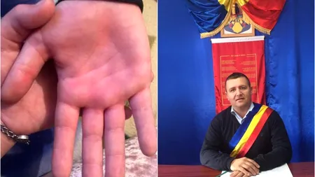 Detalii șocante în cazul învățătorului care a bătut un copil. Un primar din Vaslui îi ia apărarea: ”Dacă l-aș vedea, i-aș strânge mâna”