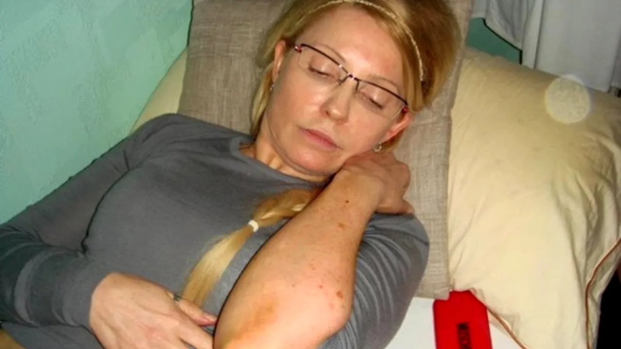 Administrația penitenciară susține că Iulia Timoșenko a avut hematoame și în trecut