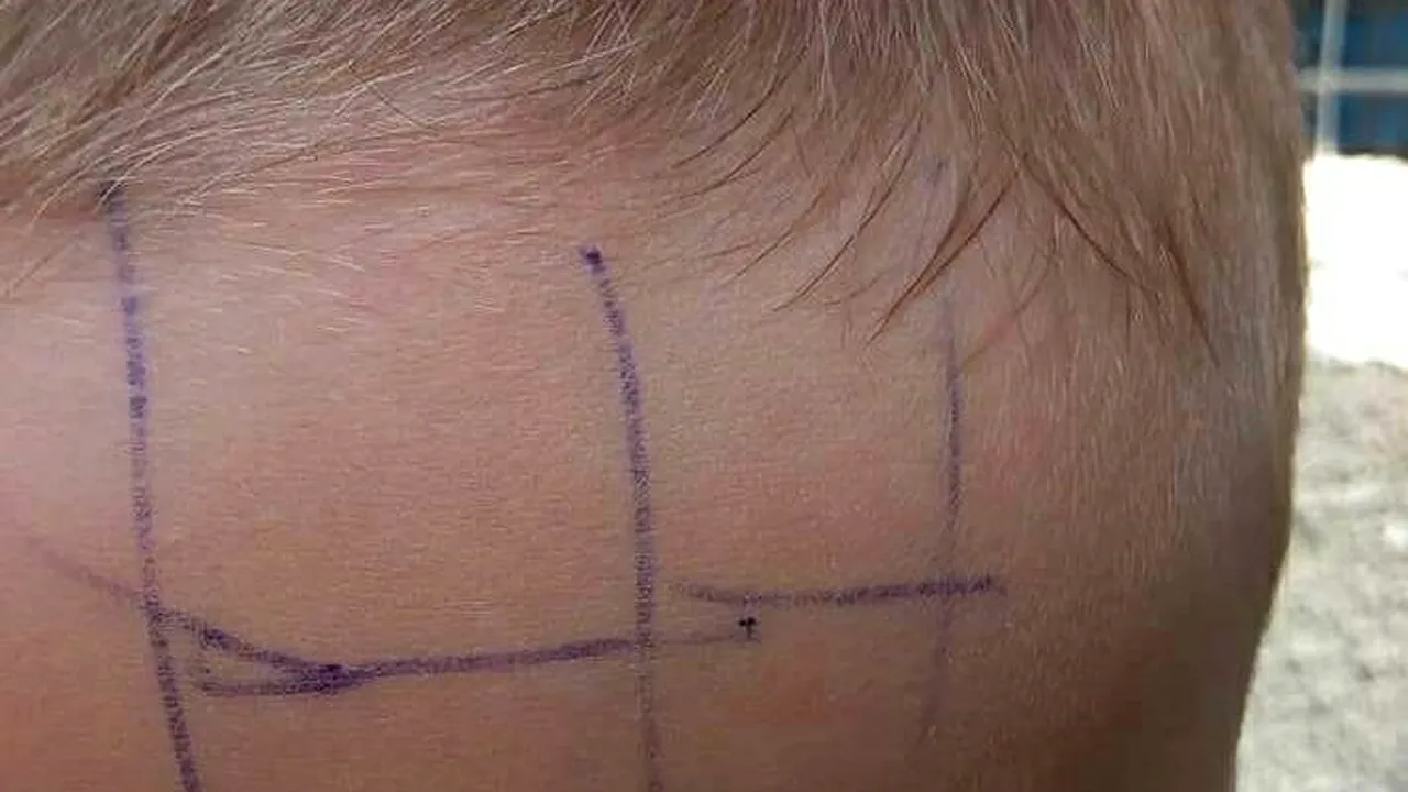 FOTOGRAFIE incredibilă de la o grădiniță din Gorj, unde un copil de 4 ani a fost scris cu pixul pe față pentru a fi pedepsit: 