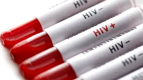 Asociaţia Română Anti-SIDA (ARAS) anunţă sistarea serviciilor sale: Infecţia cu HIV şi hepatitele virale se răspândesc deja/ Fondurile structurale nu sunt alocate şi pentru nevoile medicale şi sociale ale acestor persoane vulnerabile şi defavorizate