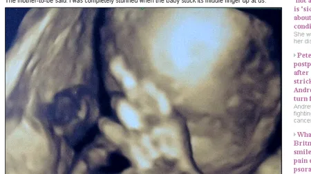 FOTO. Gestul făcut de un bebeluș în timpul ecografiei