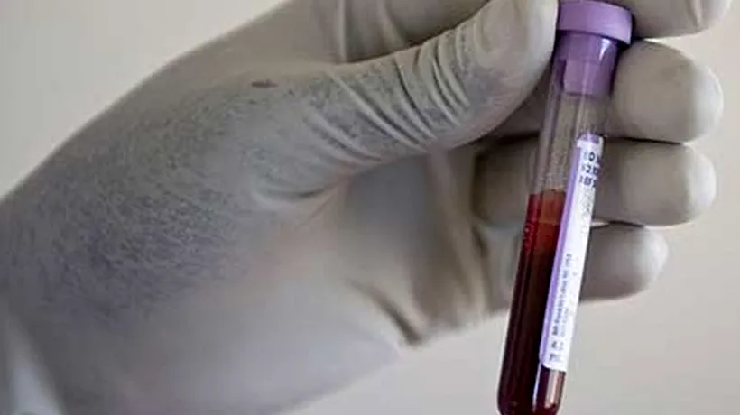 Sânge artificial creat de cercetători clujeni, testat pe șoareci cu rezultate încurajatoare