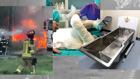 EXCLUSIV | Supraviețuitor din Colectiv: ”Un pacient cu arsură severă salvat în Germania costă 350.000 de euro. În România, se dau doar 90.000 de euro”