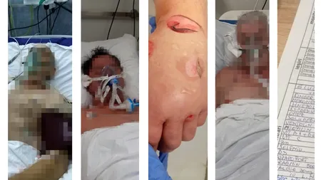 Un medic din Sibiu dezvăluie ce se întâmplă într-o secție ATI. „Oamenii sunt sedați, răstigniți ca vitele, legați de paturi!”