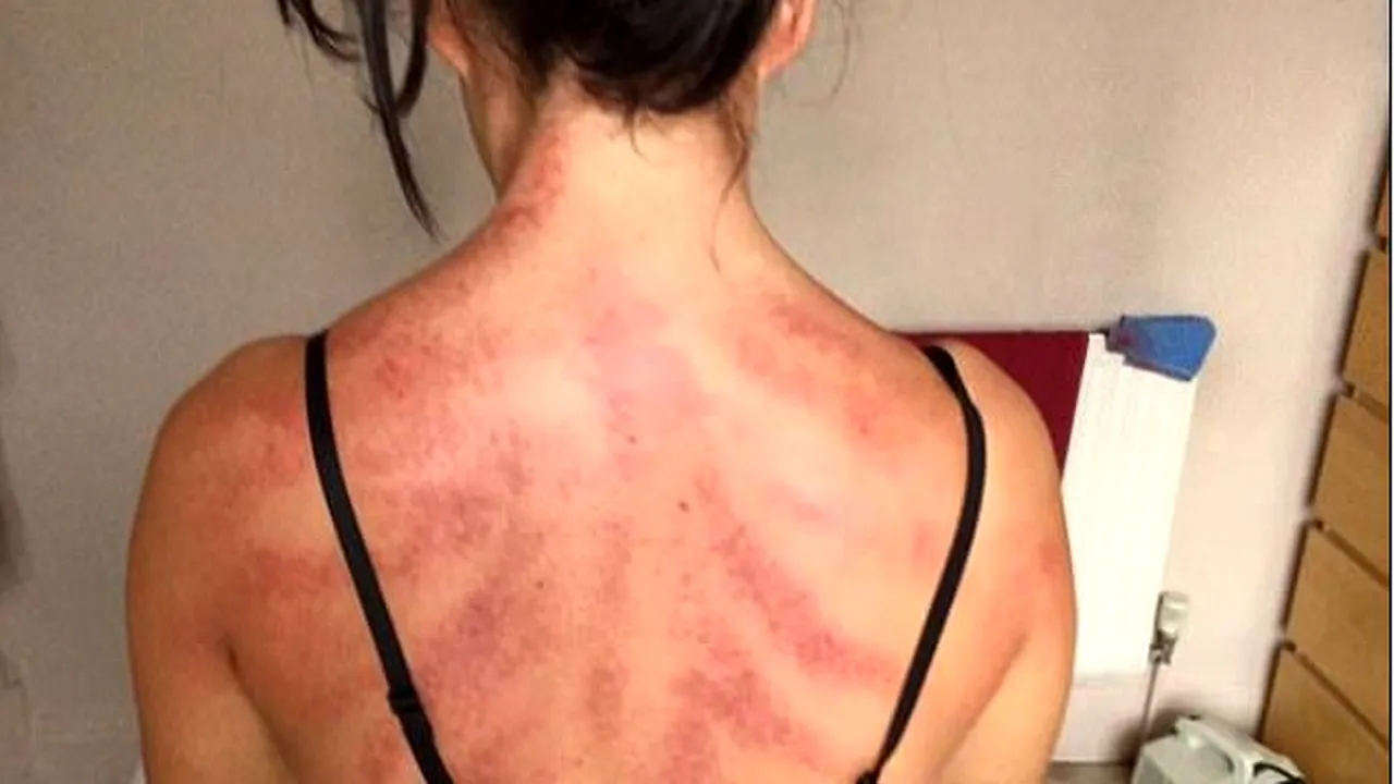 Femeia din imagine pare că a avut un accident, însă adevărul este altul. Detaliul care a șocat pe toată lumea