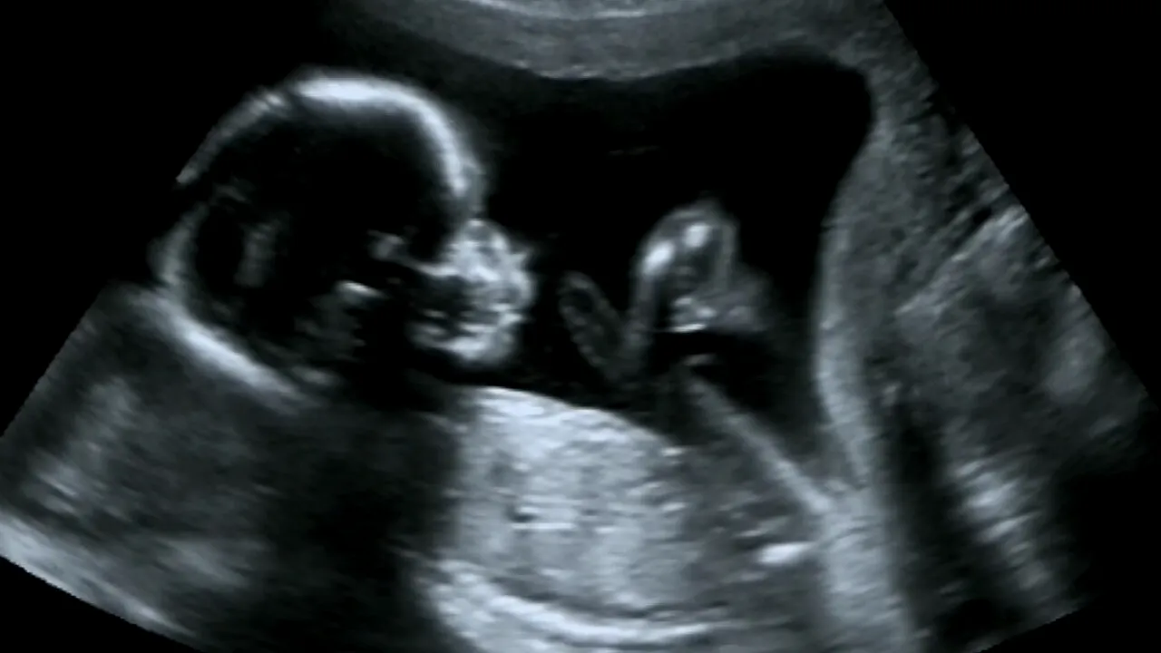 O femeie însărcinată s-a dus să își facă un RMN, dar s-a îngrozit! Imaginile au fost terifiante