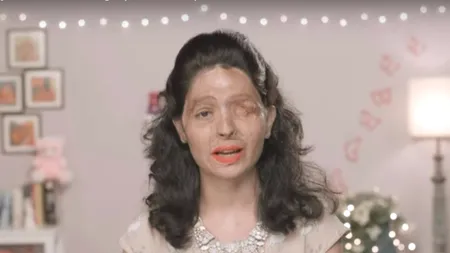 A fost arsă cu acid sulfuric la 17 ani. Acum a făcut un tutorial de make-up care transmite un mesaj cutremurător