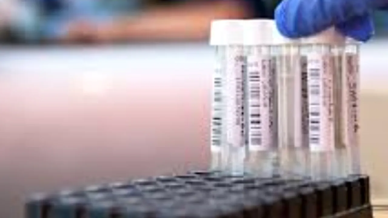 Austria începe testarea în masă. Toți profesorii si ofițerii de poliție urmează să fie testați. „Cetățenii trebuie să poată sărbători Crăciunul”