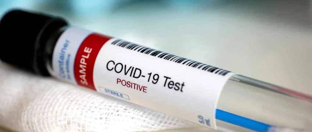 APEL. USR Ilfov cere Primăriei Măgurele să cumpere teste pentru coronavirus care să fie procesate la două clinici private